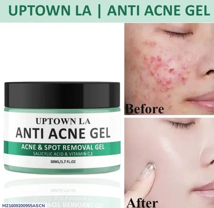 Uptown LA Anti Acne Gel 50ml Oil Control
