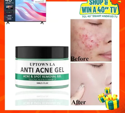Uptown LA Anti Acne Gel 50ml Oil Control